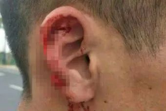 宝安沙井碰瓷_高速公路碰瓷 防范碰瓷套路 高速公路交通安全