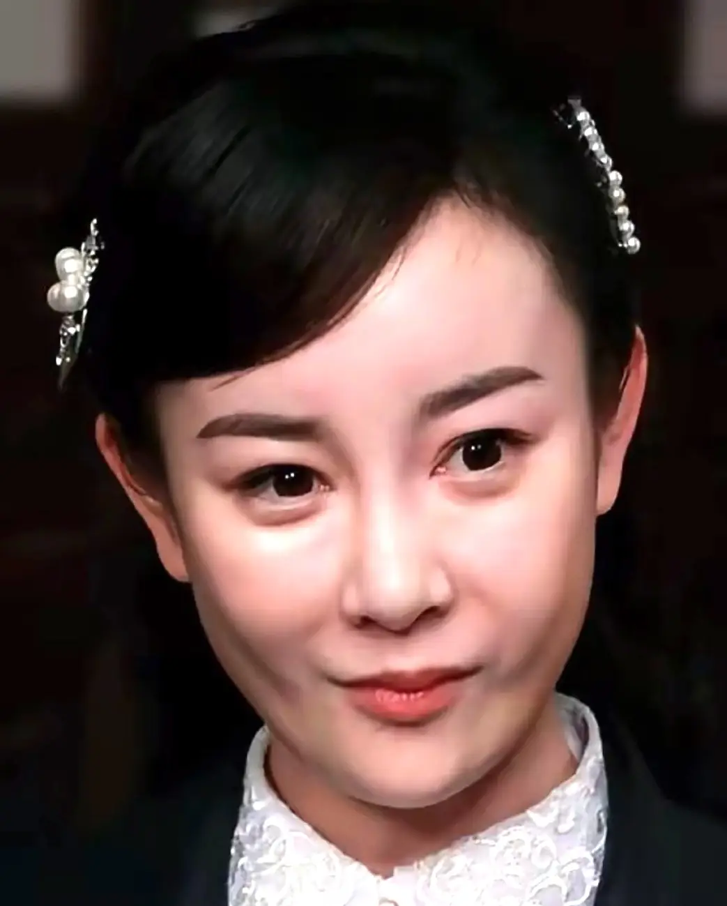 演员整容后遗症_张檬整容后悔_天龙八部张檬