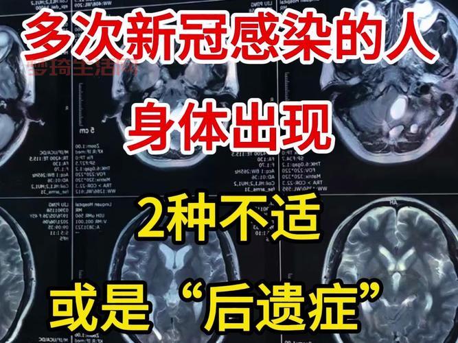 感染新冠8天就转阴了，过来人说说真实经历！