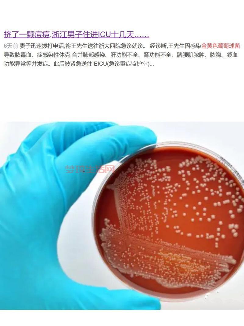 金色葡萄球菌怎么预防？日常注意这几点就行！