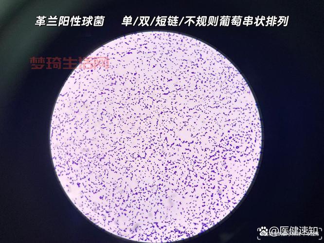 金色葡萄球菌怎么预防？日常注意这几点就行！