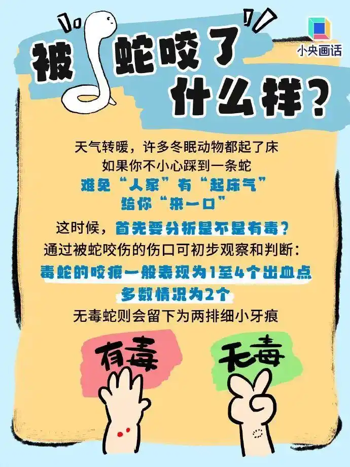 误将眼镜王蛇当无毒蛇 男子被咬身亡_南宁毒蛇咬伤急救_眼镜王蛇咬伤症状