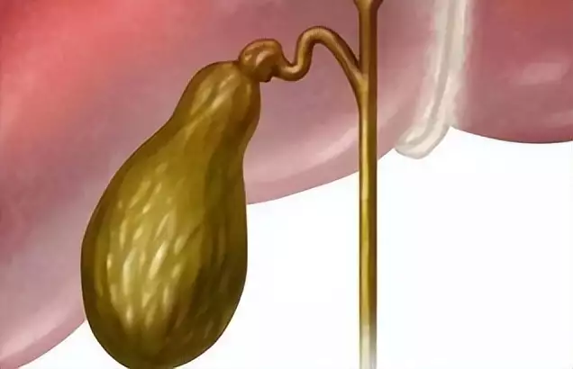 憋尿对胆囊的影响_长期憋尿胆囊癌风险_憋尿的坏处