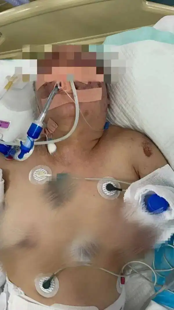 警方通报“女子遭前夫殴打致死”_母亲被前夫殴打重伤筹款_离婚后遭遇家暴医疗费求助