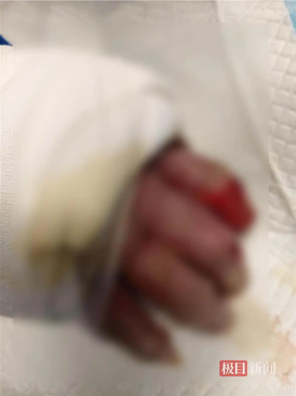 男子帮邻居关液化气瓶遇爆炸去世_燃气泄漏爆炸 严重烧伤 医疗费用