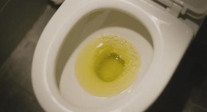 水中毒风险_人不喝水会死吗_喝水不足的危害