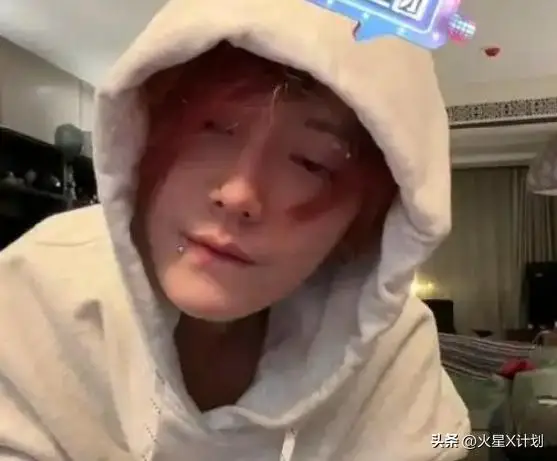 白鹿回应暴瘦到86斤_鹿晗商业合同曝光_鹿晗暴瘦原因