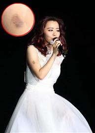 王铮亮救场_张靓颖演唱会摔下两米高舞台_张靓颖北京演唱会舞台跌落