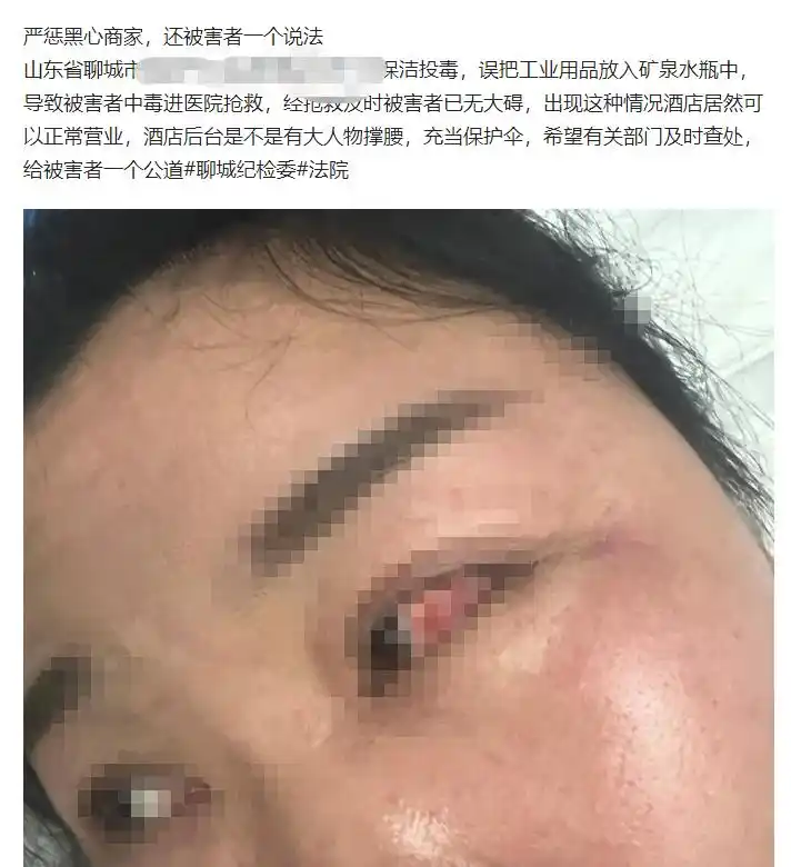 女子称酒店矿泉水喝出美瞳 酒店回应_酒店恶意讹钱投诉_山东聊城冠县酒店工业用品矿泉水中毒