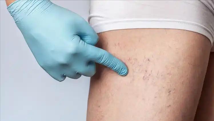 冬季老年人洗澡频率_洗澡用什么洗最好_老年人冬季洗澡注意事项