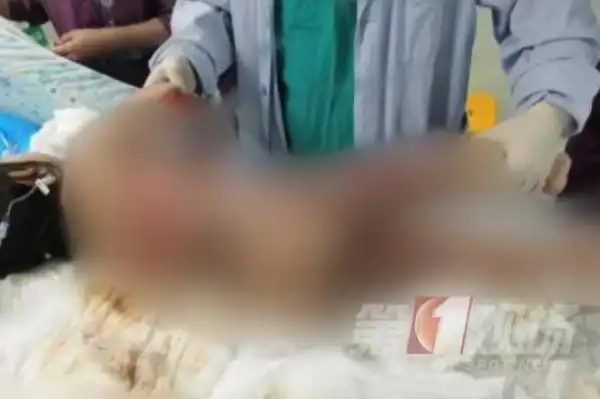 因为洗澡，2岁娃被送进ICU！医生：记牢五个字能救命