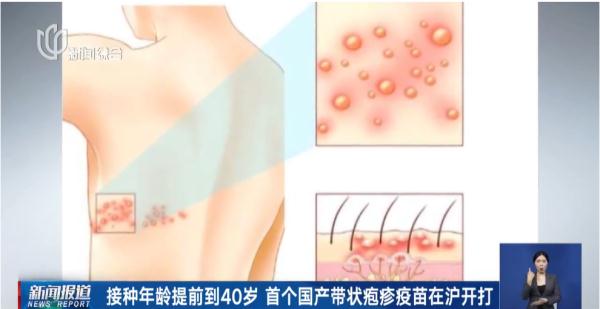 上海就诊人数明显增多！此病进入高发期，一旦感染……