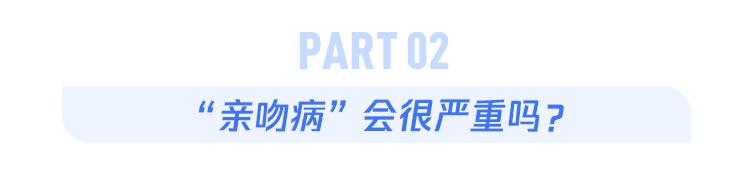 EB病毒感染_亲吻病_美国爆发“接吻虫病”疫情