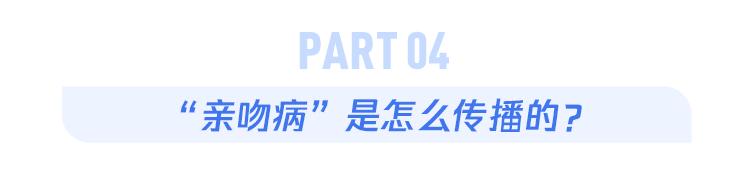 美国爆发“接吻虫病”疫情_亲吻病_EB病毒感染