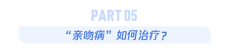 美国爆发“接吻虫病”疫情_亲吻病_EB病毒感染
