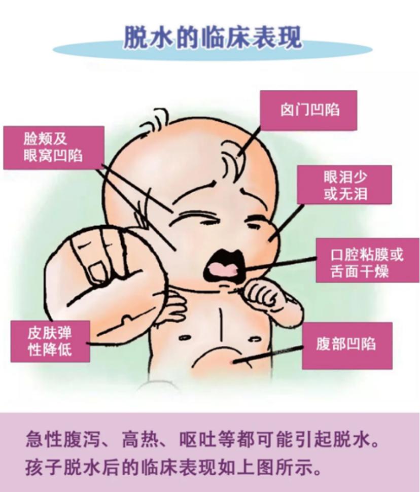小儿急性肠胃炎治疗_小儿急性肠胃炎症状_急性拉肚子吃什么好的最快