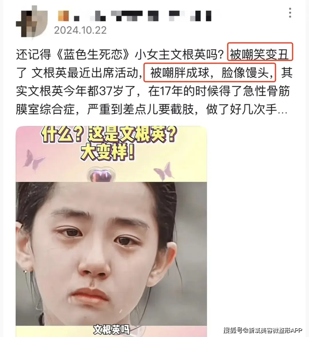 文根英现状_文根英近况变化_43岁孙艺珍分享极端减肥经历