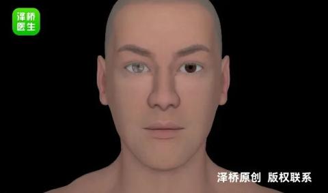 年轻人也会脑卒中?这些症状要警惕_过度劳累脑梗风险_年轻人血管堵塞