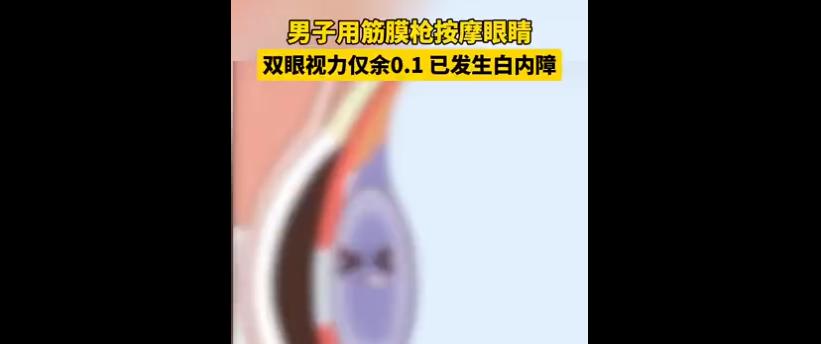 女子用筋膜枪按摩眼睛险失明_筋膜枪视力下降_白内障筋膜枪损伤