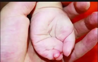 雨夜弃婴_护士发现弃婴停尸房真相_江西弃婴雨中太平间生存八天