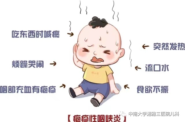 流感毒株变了!中疾控提醒_嗓子疼 新冠 新毒株