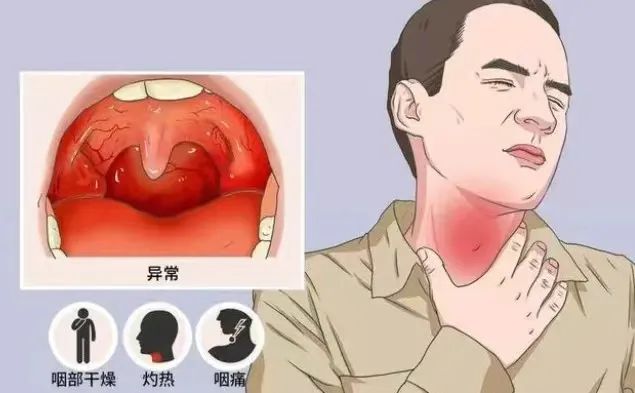 嗓子疼 新冠 新毒株_流感毒株变了!中疾控提醒